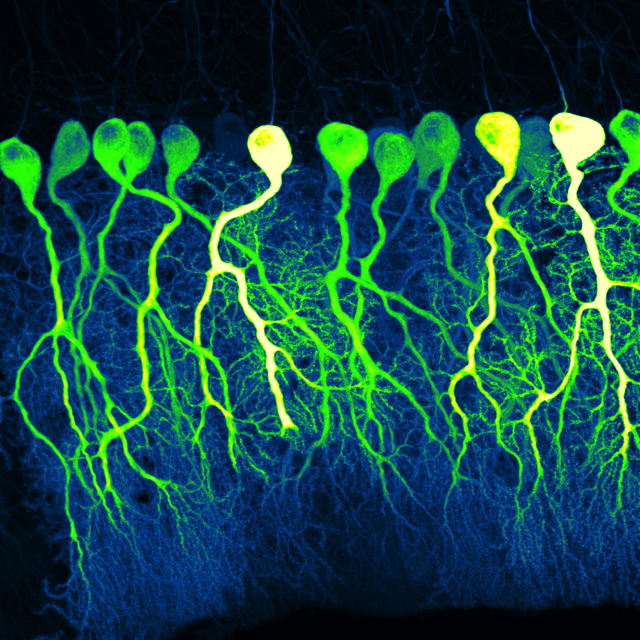 Silas Busch award winning neuro image