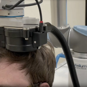 transcranial magnetic stimulation